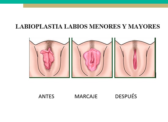 Ginecologia regenerativa
