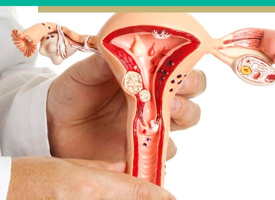 Clínica de endometriosis